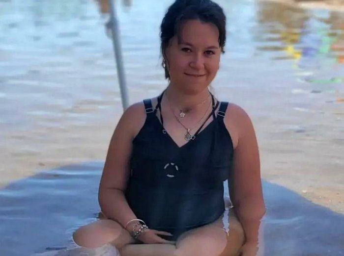 La gualeya fue diagnosticada con una enfermedad poco frecuente cuando ten&iacute;a poco m&aacute;s de 1 a&ntilde;o.