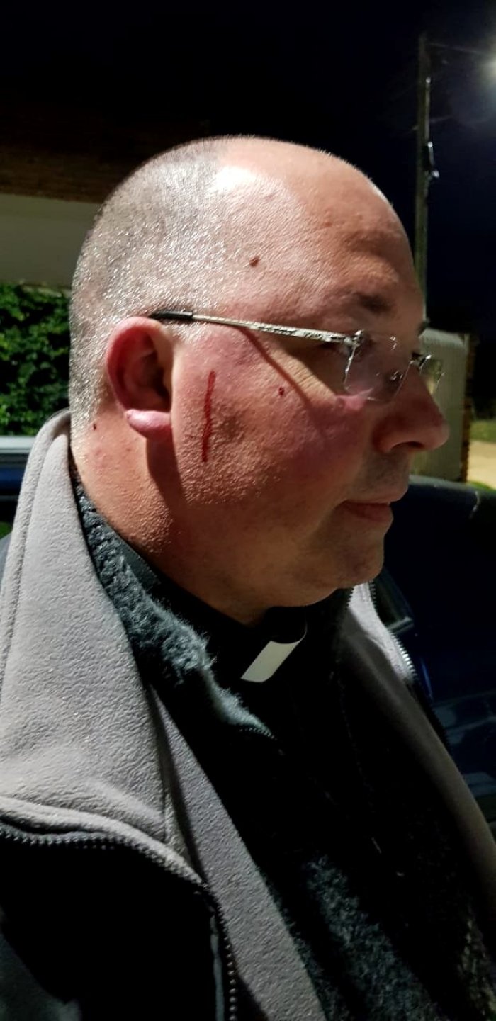 Tras el estallido del vidrio, Bonetta sufri&oacute; algunas heridas