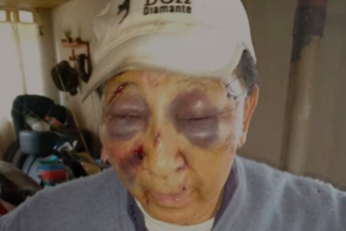 As&iacute; hab&iacute;a quedado el hombre tras el asalto