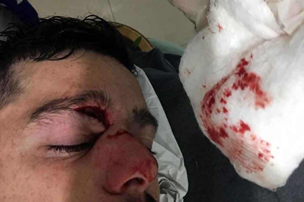 As&iacute; qued&oacute; el rosto de David Telechea