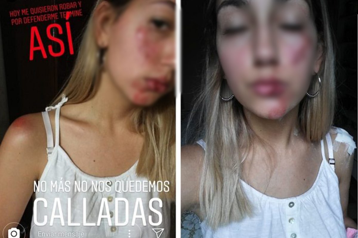 Rasgos fueron difuminados por ser menor de edad