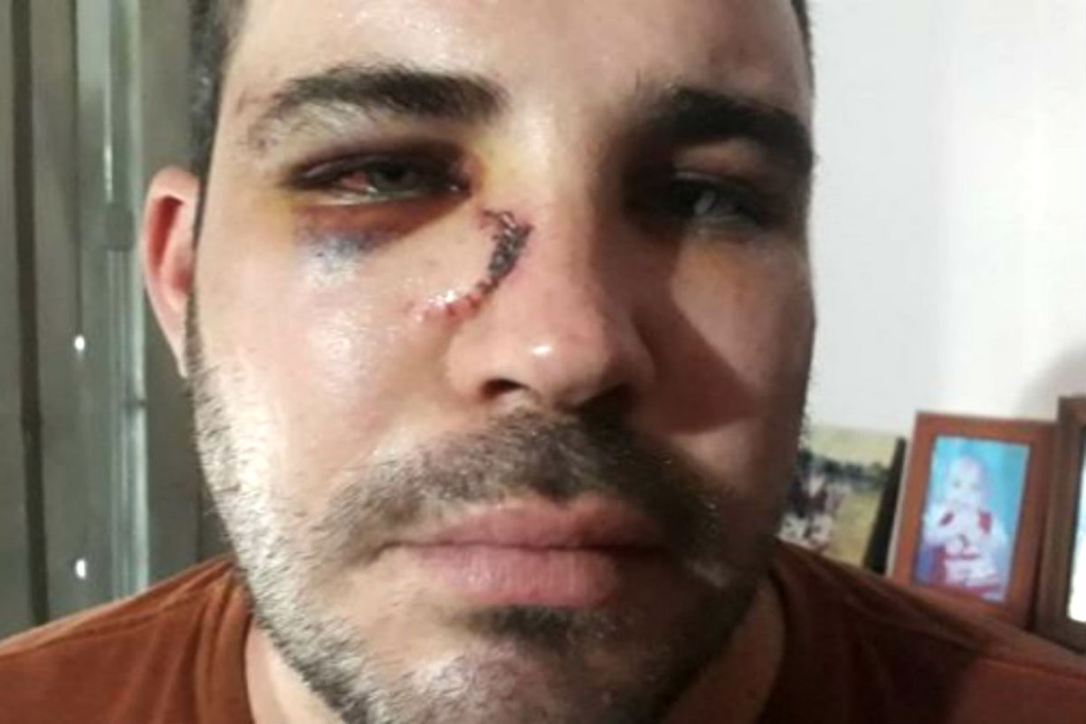R&iacute;os dice que fue golpeado por polic&iacute;as.