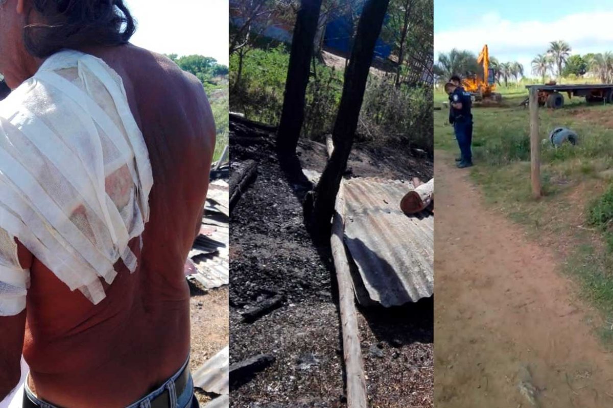 Un hombre sufri&oacute; heridas por el incendio